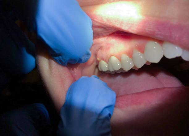Best Emergency Treatment for Toothache in Lebanon, PA